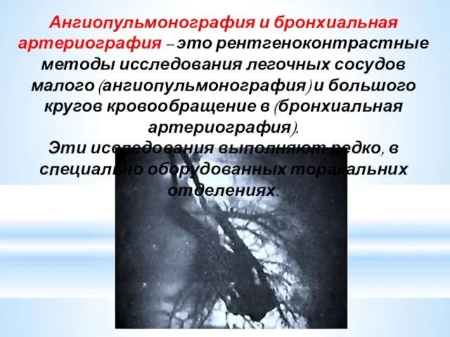 Ангиопульмонография и бронхиальная артериография – это рентгеноконтрастные методы исследования легочных сосудов