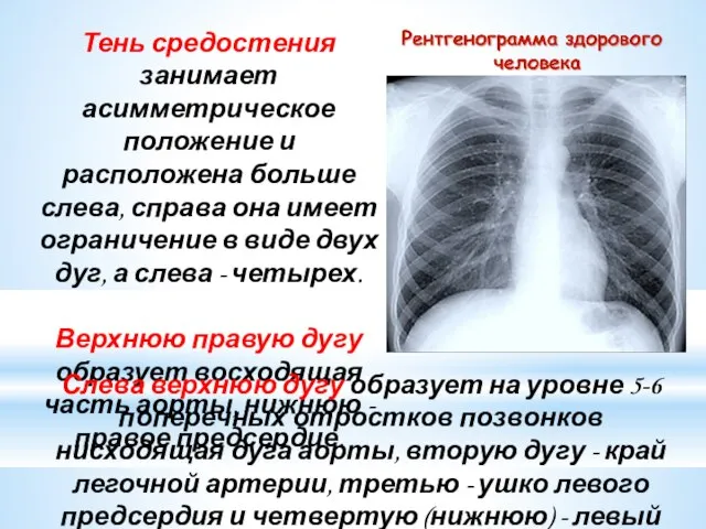 Тень средостения занимает асимметрическое положение и расположена больше слева, справа она