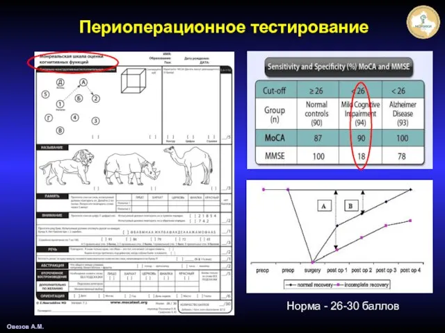 Овезов А.М. Периоперационное тестирование Норма - 26-30 баллов