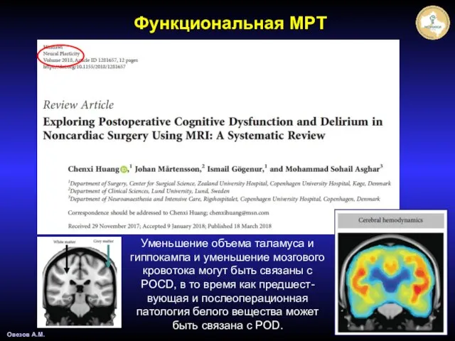 Овезов А.М. Функциональная МРТ Уменьшение объема таламуса и гиппокампа и уменьшение