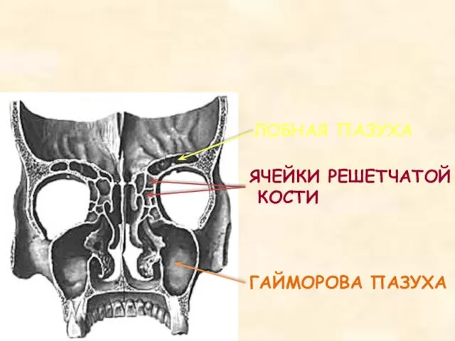 ГАЙМОРОВА ПАЗУХА ЛОБНАЯ ПАЗУХА ЯЧЕЙКИ РЕШЕТЧАТОЙ КОСТИ