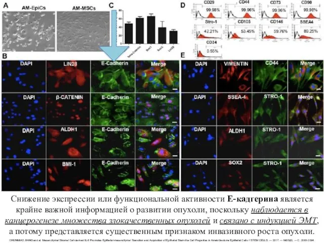 Снижение экспрессии или функциональной активности Е-кадгерина является крайне важной информацией о