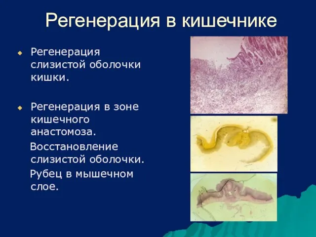 Регенерация в кишечнике Регенерация слизистой оболочки кишки. Регенерация в зоне кишечного