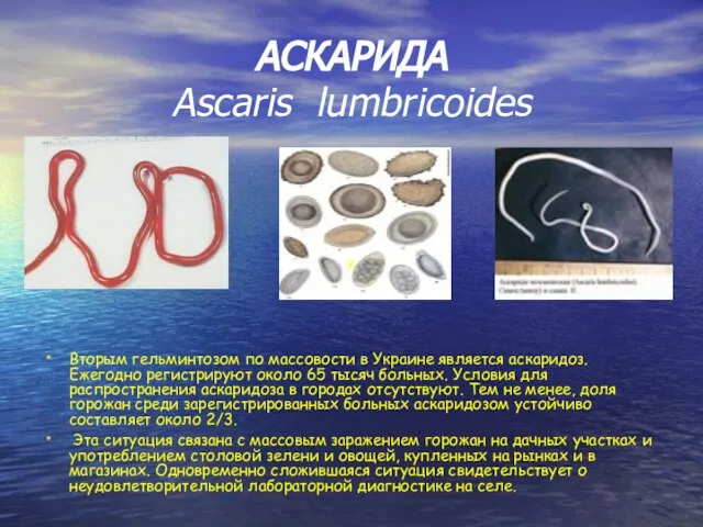 АСКАРИДА Ascaris lumbricoides Вторым гельминтозом по массовости в Украине является аскаридоз.