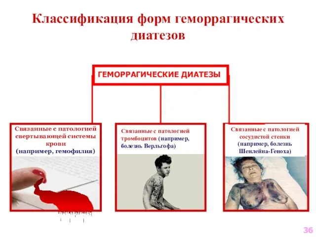 Связанные с патологией свертывающей системы крови (например, гемофилия) Связанные с патологией