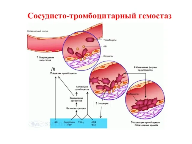 Сосудисто-тромбоцитарный гемостаз /#