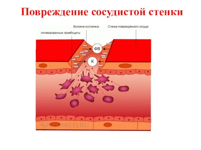 Повреждение сосудистой стенки