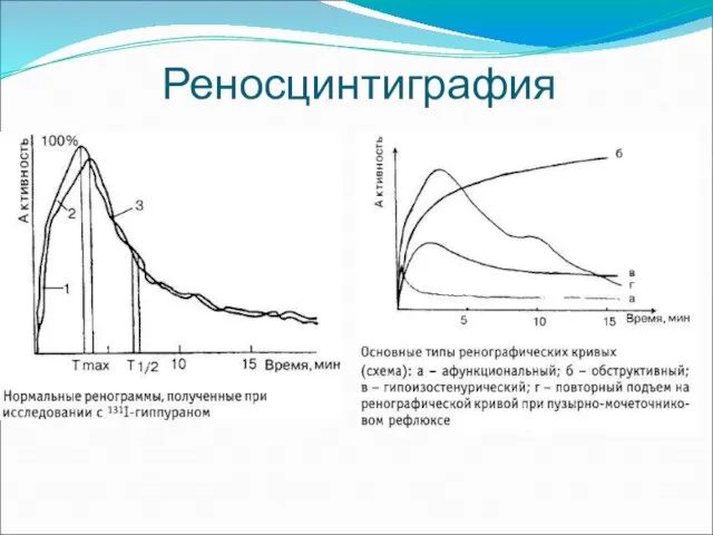 Реносцинтиграфия