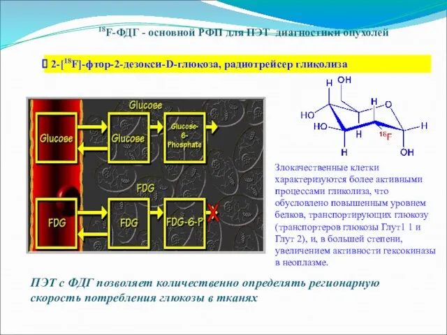 18F-ФДГ - основной РФП для ПЭТ диагностики опухолей 2-[18F]-фтор-2-дезокси-D-глюкоза, радиотрейсер гликолиза