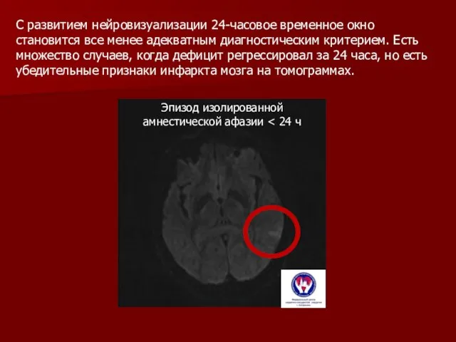 С развитием нейровизуализации 24-часовое временное окно становится все менее адекватным диагностическим