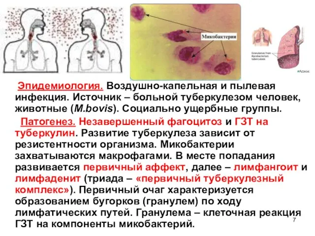 Эпидемиология. Воздушно-капельная и пылевая инфекция. Источник – больной туберкулезом человек, животные