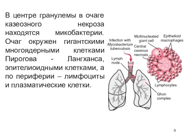 В центре гранулемы в очаге казеозного некроза находятся микобактерии. Очаг окружен