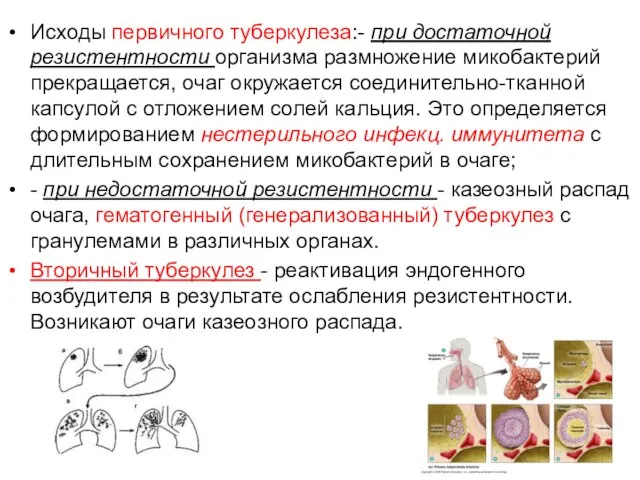 Исходы первичного туберкулеза:- при достаточной резистентности организма размножение микобактерий прекращается, очаг