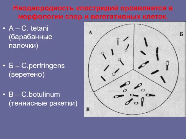 Неоднородность клостридий проявляется в морфологии спор и вегетативных клеток. А –