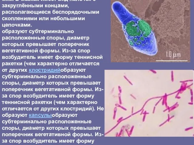 Возбудитель ботулизма Clostridium botulinum относится к роду Clostridium, семейству Bacillaceae. Это