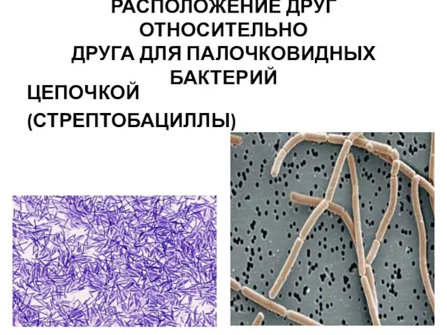 РАСПОЛОЖЕНИЕ ДРУГ ОТНОСИТЕЛЬНО ДРУГА ДЛЯ ПАЛОЧКОВИДНЫХ БАКТЕРИЙ ЦЕПОЧКОЙ (СТРЕПТОБАЦИЛЛЫ)