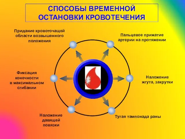 СПОСОБЫ ВРЕМЕННОЙ ОСТАНОВКИ КРОВОТЕЧЕНИЯ Пальцевое прижатие артерии на протяжении Придание кровоточащей