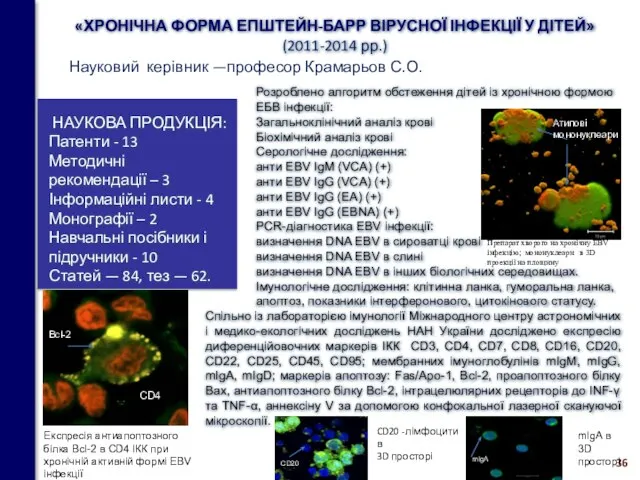 «ХРОНІЧНА ФОРМА ЕПШТЕЙН-БАРР ВІРУСНОЇ ІНФЕКЦІЇ У ДІТЕЙ» (2011-2014 рр.) НАУКОВА ПРОДУКЦІЯ: