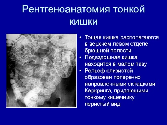 Рентгеноанатомия тонкой кишки Тощая кишка располагаются в верхнем левом отделе брюшной