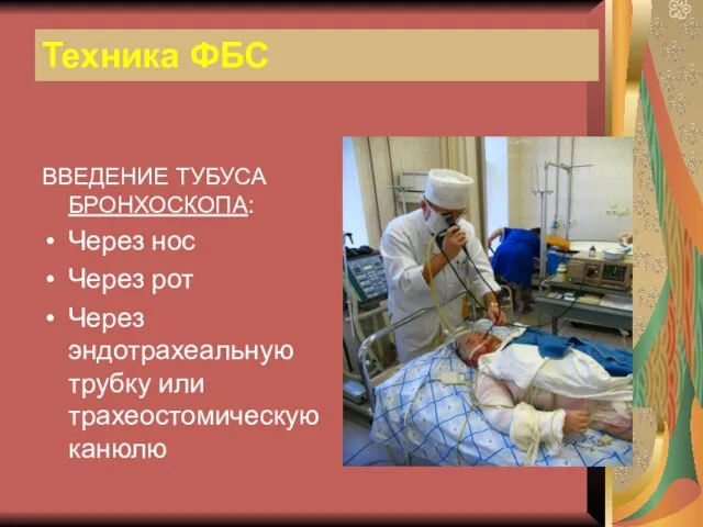 Техника ФБС ВВЕДЕНИЕ ТУБУСА БРОНХОСКОПА: Через нос Через рот Через эндотрахеальную трубку или трахеостомическую канюлю