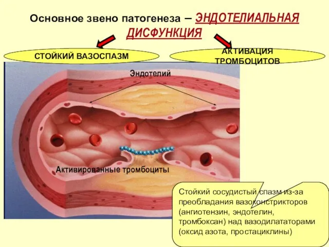 Основное звено патогенеза – ЭНДОТЕЛИАЛЬНАЯ ДИСФУНКЦИЯ Активированные тромбоциты Эндотелий Стойкий сосудистый