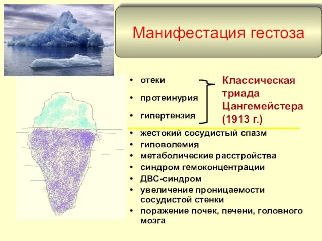 Манифестация гестоза отеки протеинурия гипертензия жестокий сосудистый спазм гиповолемия метаболические расстройства