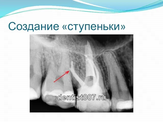 Создание «ступеньки»