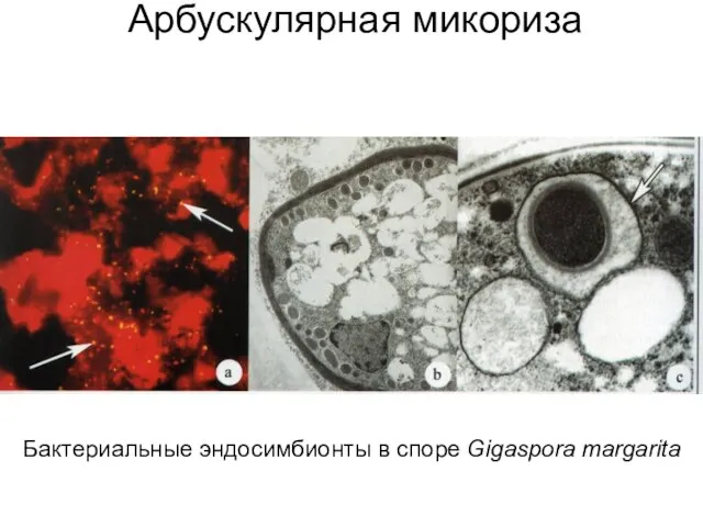 Арбускулярная микориза Бактериальные эндосимбионты в споре Gigaspora margarita