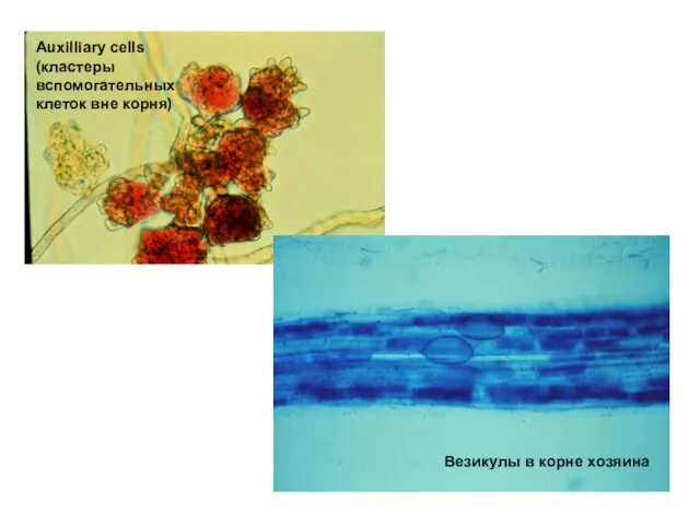Везикулы в корне хозяина Auxilliary cells (кластеры вспомогательных клеток вне корня)