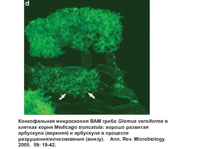 Конкофальная микроскопия ВАМ гриба Glomus versiforme в клетках корня Medicago truncatula: