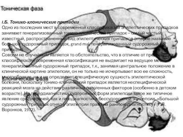 I.Б. Тонико-клонические припадки Одно из последних мест в современной классификации эпилептических