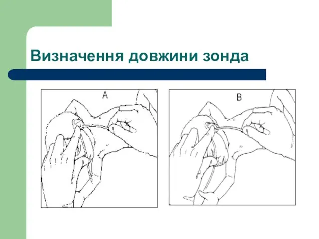 Визначення довжини зонда