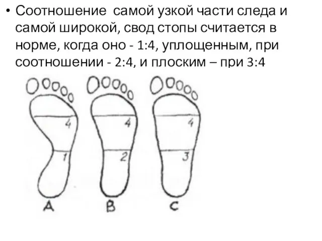 Соотношение самой узкой части следа и самой широкой, свод стопы считается