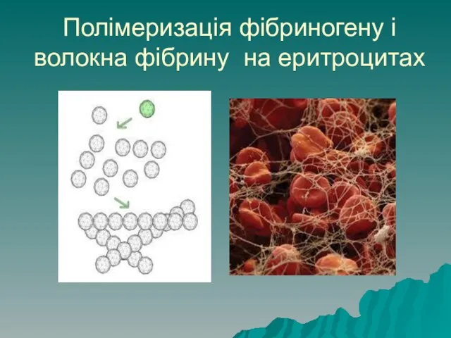 Полімеризація фібриногену і волокна фібрину на еритроцитах