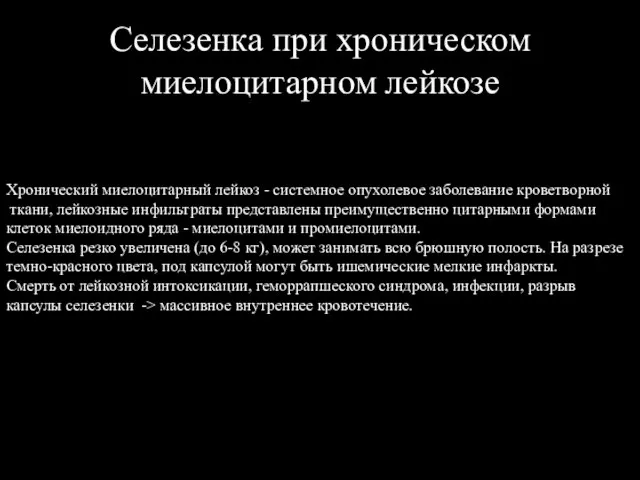 Селезенка при хроническом миелоцитарном лейкозе Хронический миелоцитарный лейкоз - системное опухолевое