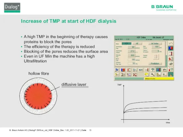 Increase of TMP at start of HDF dialysis hollow fibre diffusive
