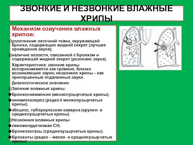 ЗВОНКИЕ И НЕЗВОНКИЕ ВЛАЖНЫЕ ХРИПЫ Механизм озвучения влажных хрипов: уплотнение легочной