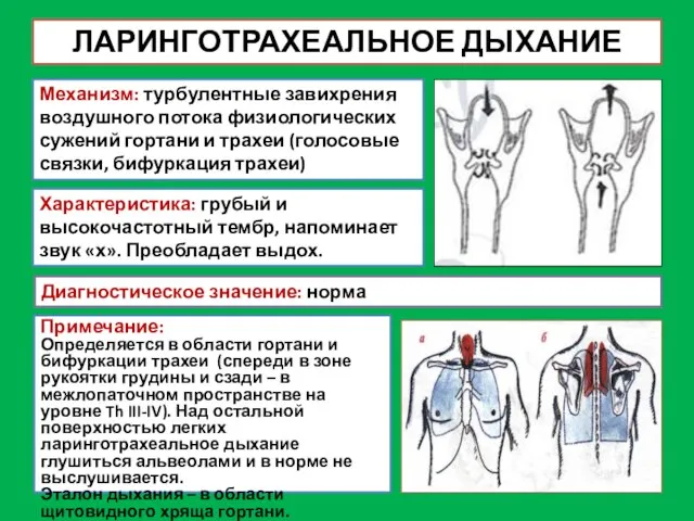 ЛАРИНГОТРАХЕАЛЬНОЕ ДЫХАНИЕ Механизм: турбулентные завихрения воздушного потока физиологических сужений гортани и