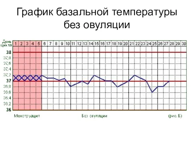 График базальной температуры без овуляции