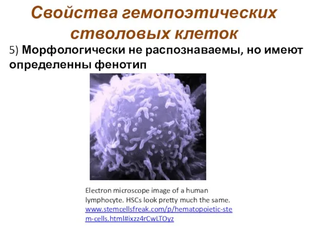Свойства гемопоэтических стволовых клеток Electron microscope image of a human lymphocyte.