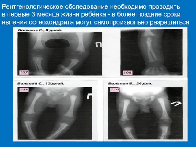 Рентгенологическое обследование необходимо проводить в первые 3 месяца жизни ребёнка -