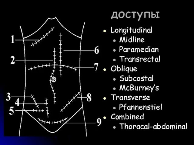 доступы Longitudinal Midline Paramedian Transrectal Oblique Subcostal McBurney’s Transverse Pfannenstiel Combined Thoracal-abdominal