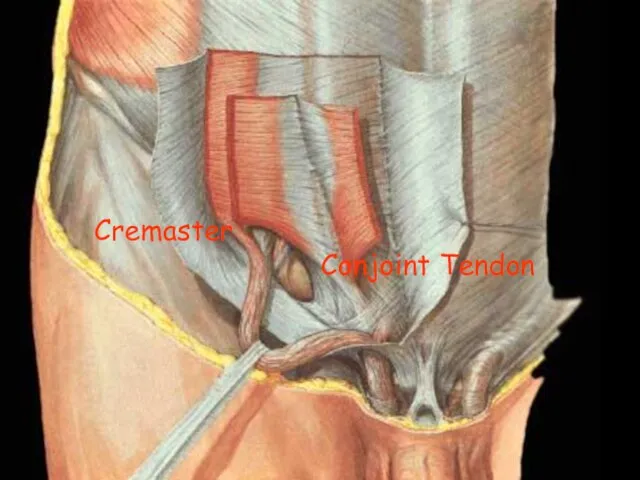 Conjoint Tendon Cremaster