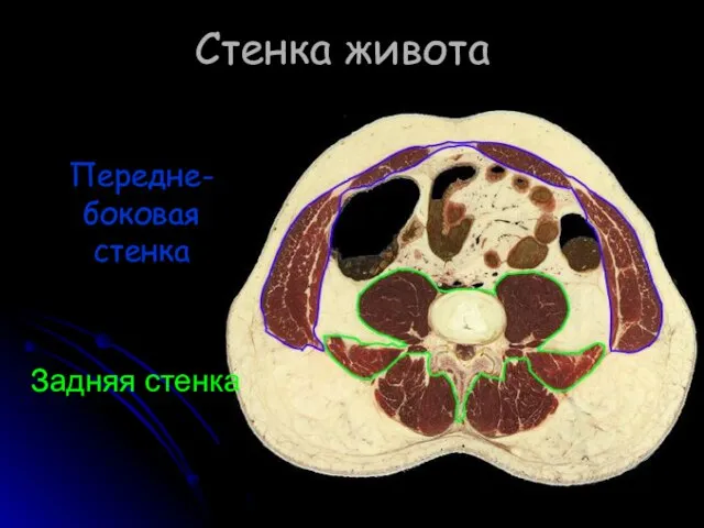 Стенка живота Передне-боковая стенка Задняя стенка