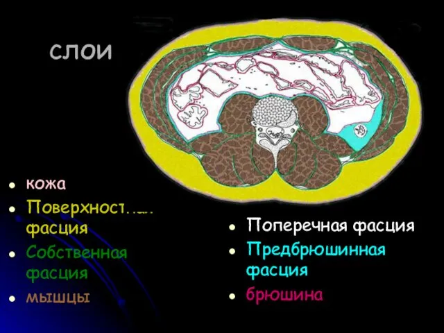 слои кожа Поверхностная фасция Собственная фасция мышцы Поперечная фасция Предбрюшинная фасция брюшина