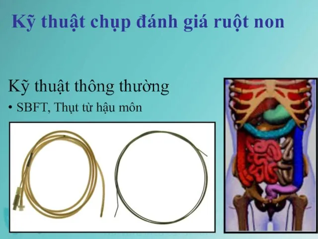 Kỹ thuật chụp đánh giá ruột non Kỹ thuật thông thường