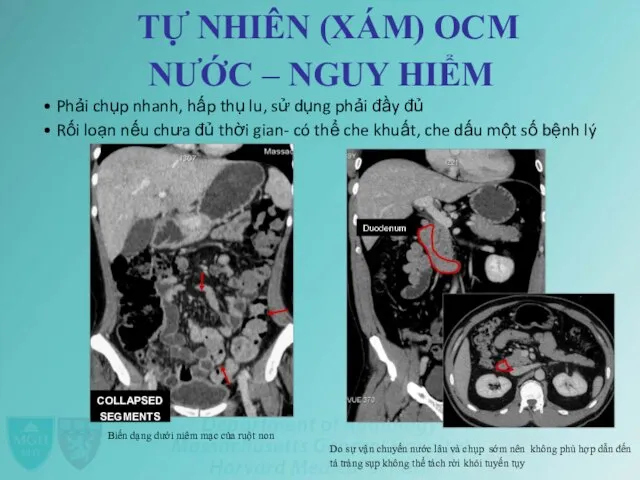 TỰ NHIÊN (XÁM) OCM NƯỚC – NGUY HIỂM • Phải chụp