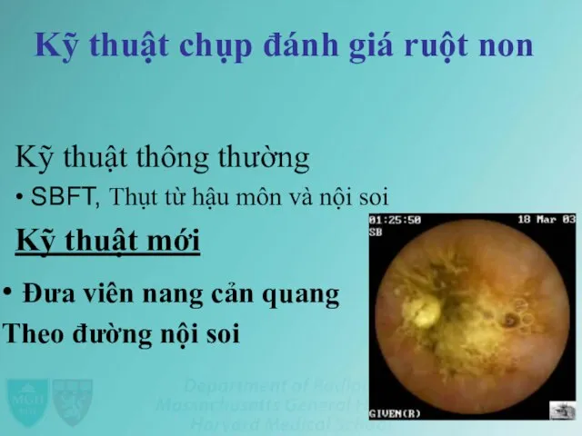 Kỹ thuật chụp đánh giá ruột non Kỹ thuật thông thường