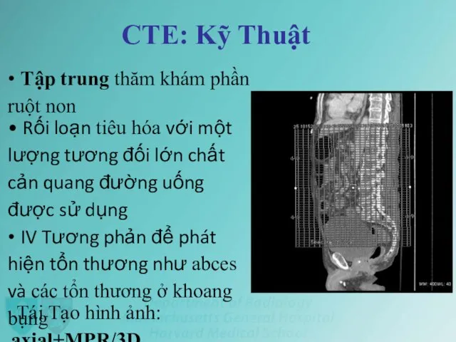 CTE: Kỹ Thuật • Tập trung thăm khám phần ruột non