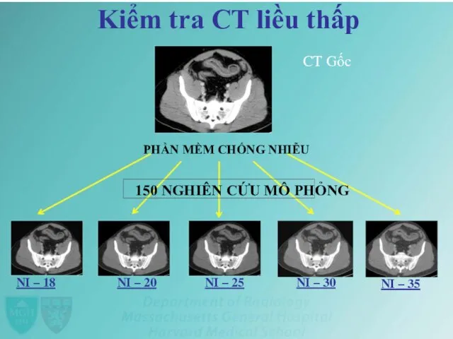 Kiểm tra CT liều thấp CT Gốc PHẦN MỀM CHỐNG NHIỄU